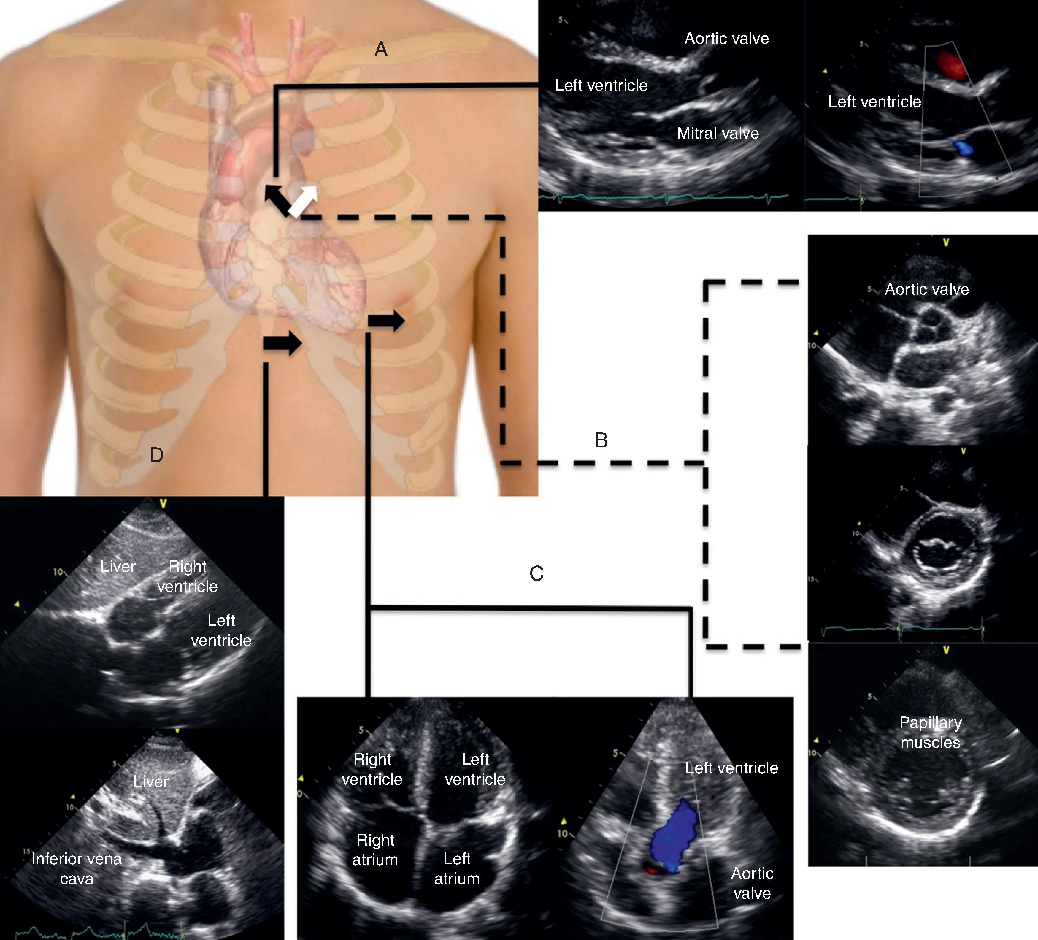 FIG. 14, Critical views of focused rapid echocardiographic examination.