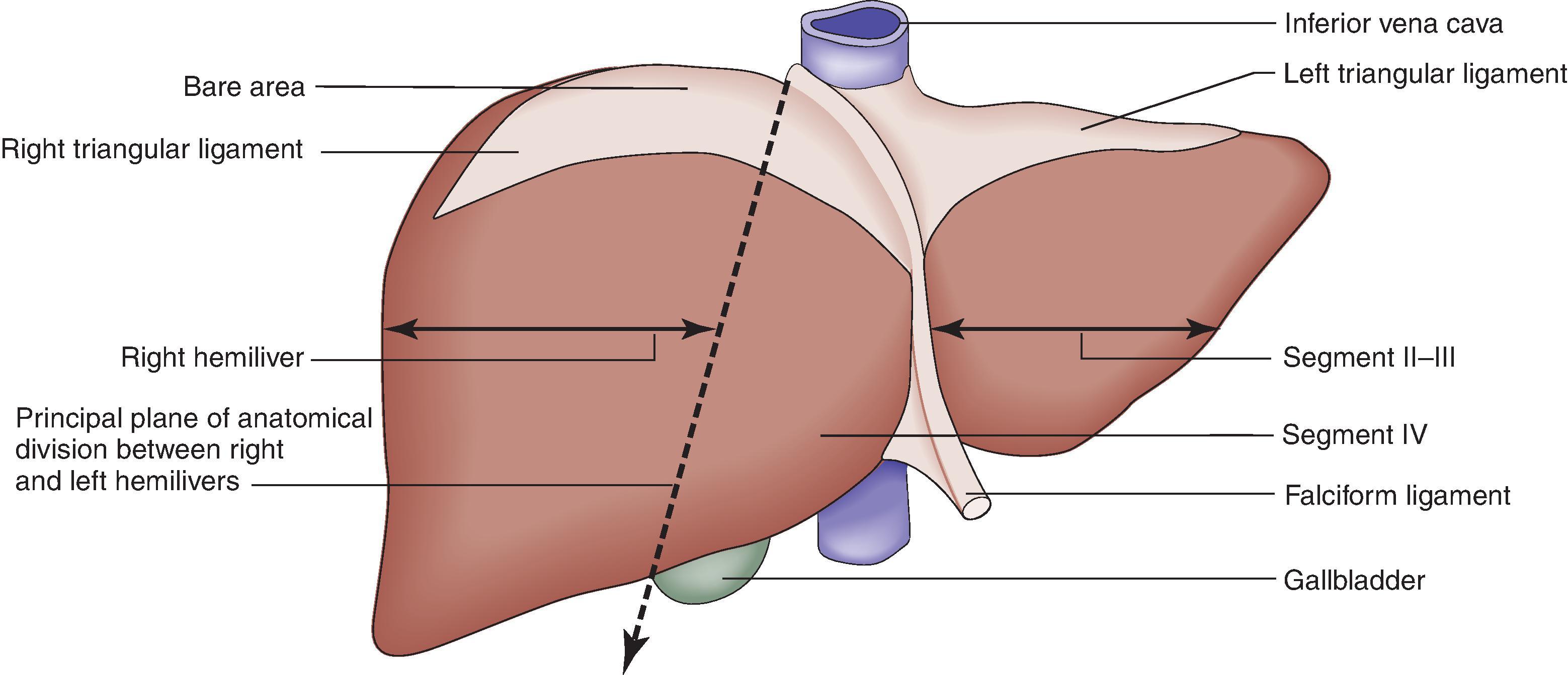 FIG. 3, Juxtahepatic (or retrohepatic) vena cava is in direct contact with the posterior aspect of the liver.