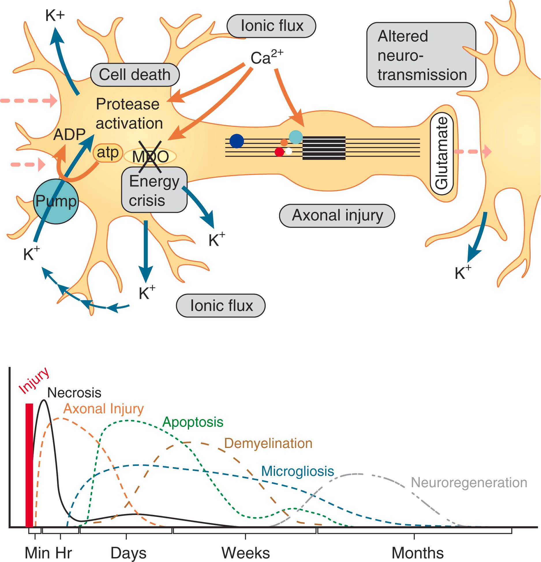 E-FIGURE 368-1, Axonal injury ( top ) and time course of traumatic brain injury pathobiologic events ( bottom ).