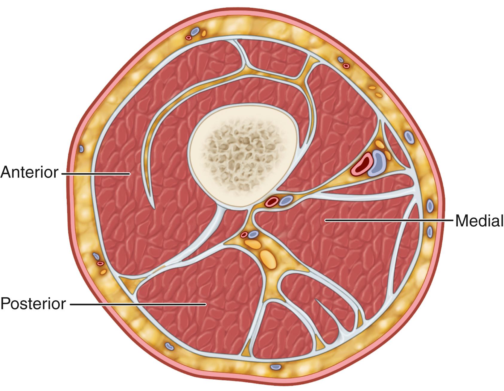 FIGURE 48.5, Three compartments of the thigh: anterior, medial, and posterior.