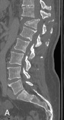 Fig. 129.4, Fracture dislocation.