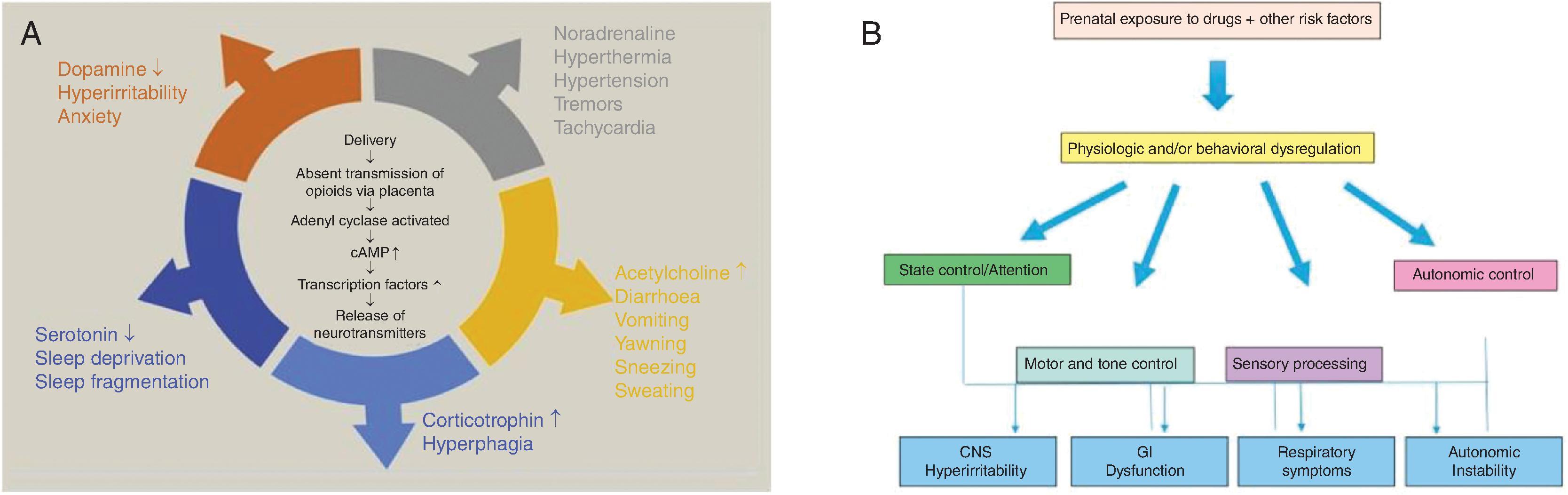 Fig. 55.1, Pathophysiology of Neonatal Abstinence Syndrome (NAS), Which May Be More Appropriately Termed Neonatal Opiate Withdrawal Syndrome (NOWS) .