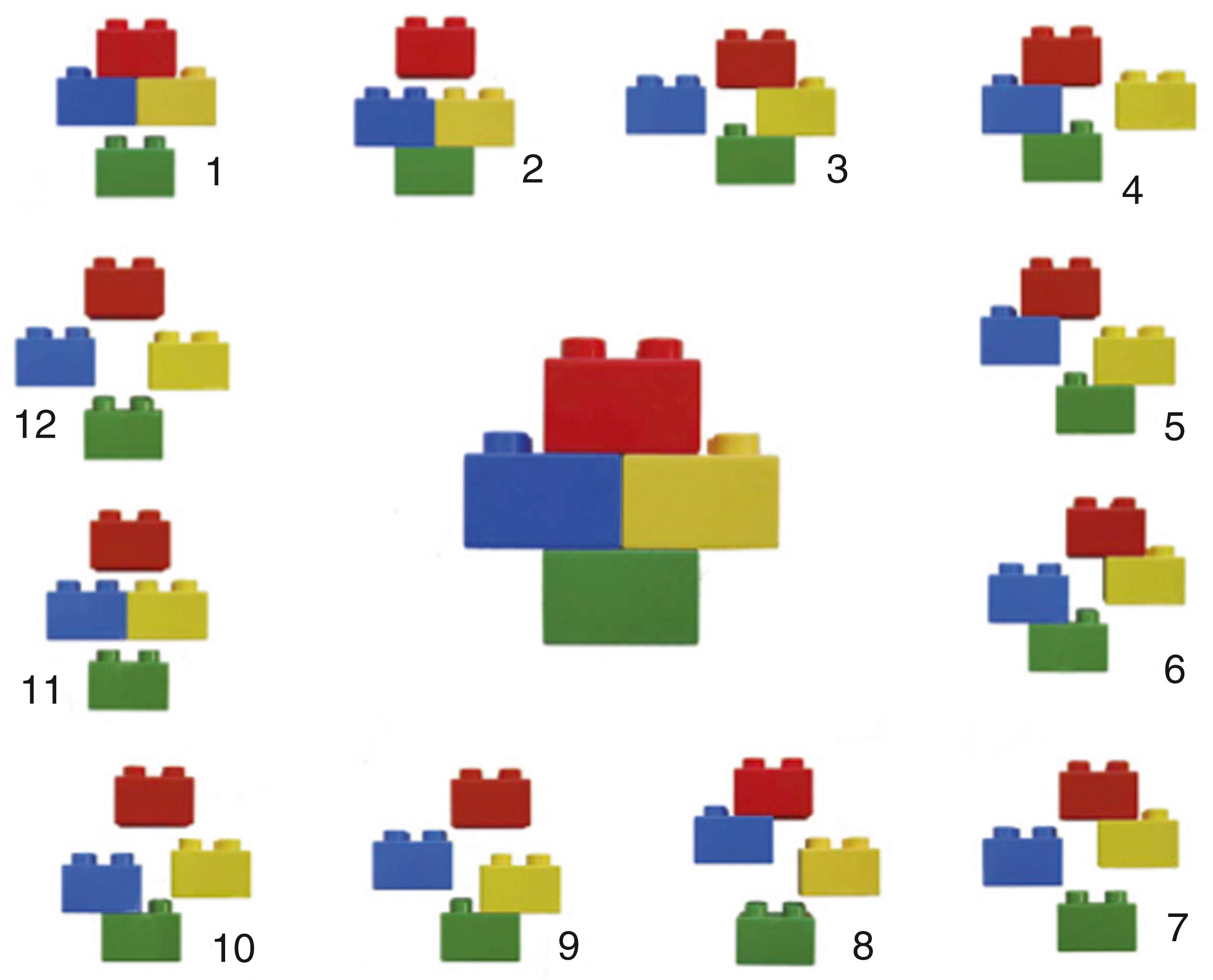 Fig. 25.4, (A) Binary (LEGO) description system with 12 basic fracture patterns ( red , head; yellow , lesser tuberosity; blue , greater tuberosity; green , shaft). (B) Length of the medial metaphyseal head extension. The longer the extension, the more likely the head is perfused. (C) Integrity of the medial hinge.