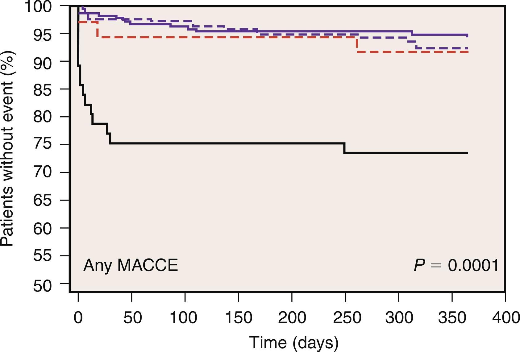 Fig. 13.5, Relationship between creatine kinase-MB isoform (CK-MB) levels and major postoperative complications after cardiac surgery. Kaplan-Meier curves illustrate the incidence of major adverse cardiac complications at 1-year follow-up in patients with normal CK-MB levels (dashed blue line) , greater than one to three times normal (solid blue line) , three or more to five times normal (dashed red line) , and greater than five times normal (solid black lines) . MACCE, Combined major cardiac death, myocardial infarction, repeat revascularization, and cerebrovascular events.