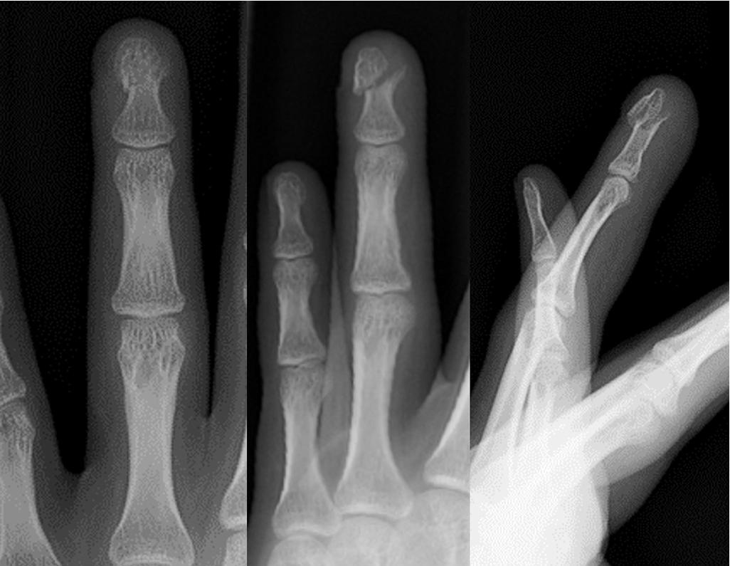 FIGURE 9.4, Preoperative x-rays.