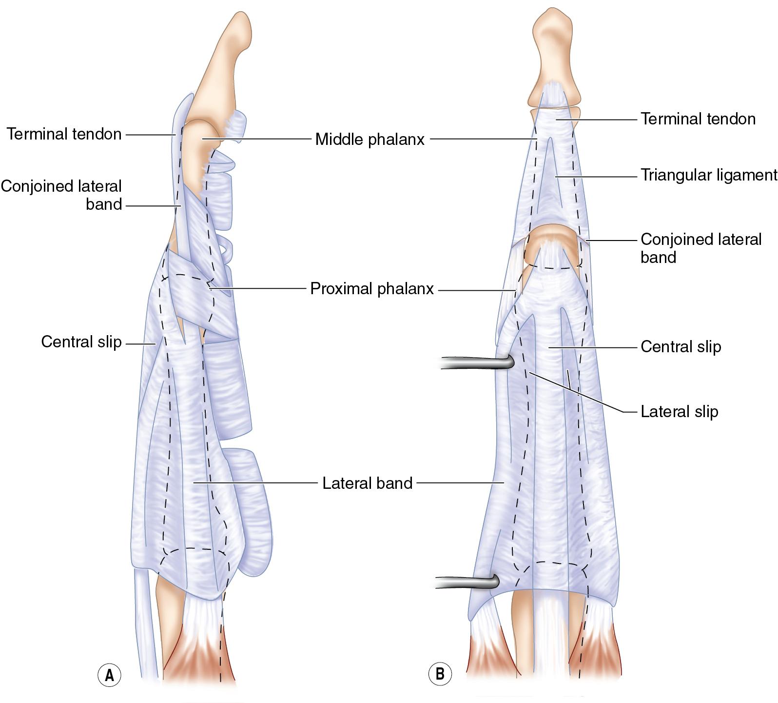 FIGURE 9.5, Surgical anatomy.