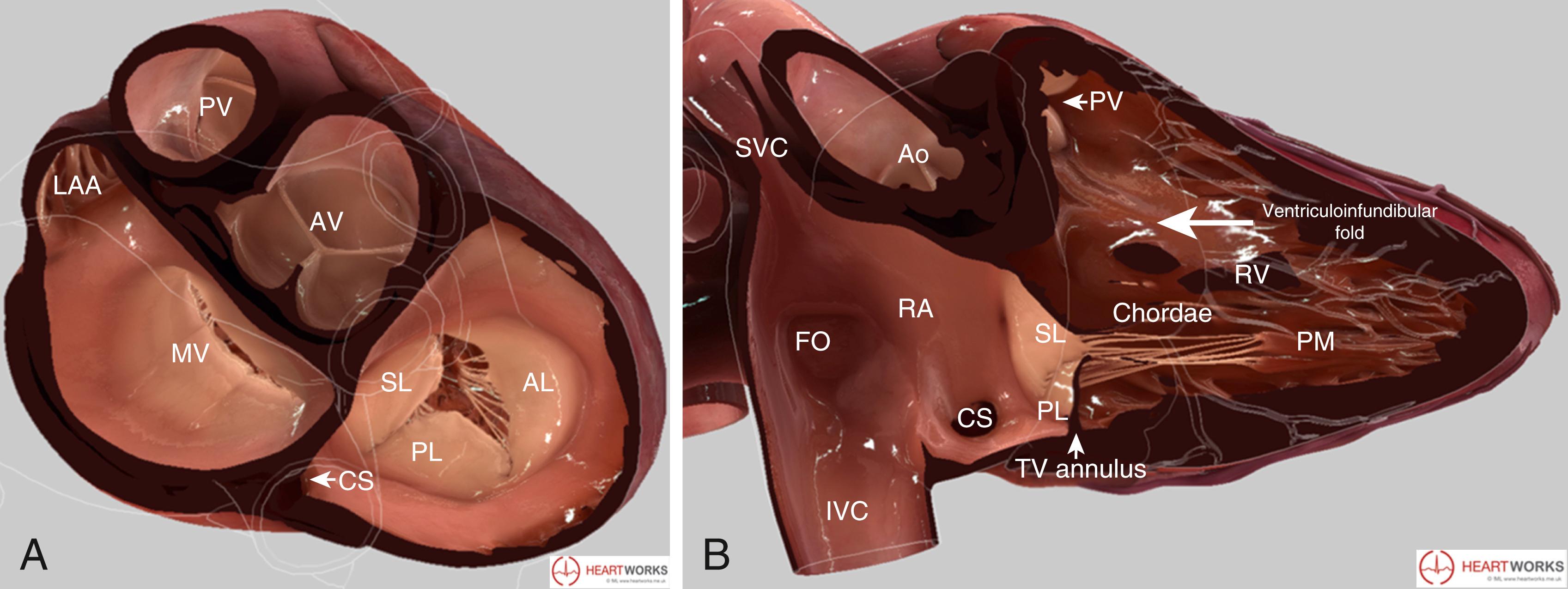 Tricuspid Valve Complex Anatomy By Two Dimensional And Three Dimensional Echocardiography