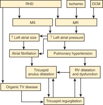 Figure 14-3, Pathogenesis of tricuspid regurgitation in mitral valve disease. Key: DCM, Dilated cardiomyopathy; MR, mitral regurgitation; MS, mitral stenosis; RHD, rheumatic heart disease; RV, right ventricle; TV, tricuspid valve.