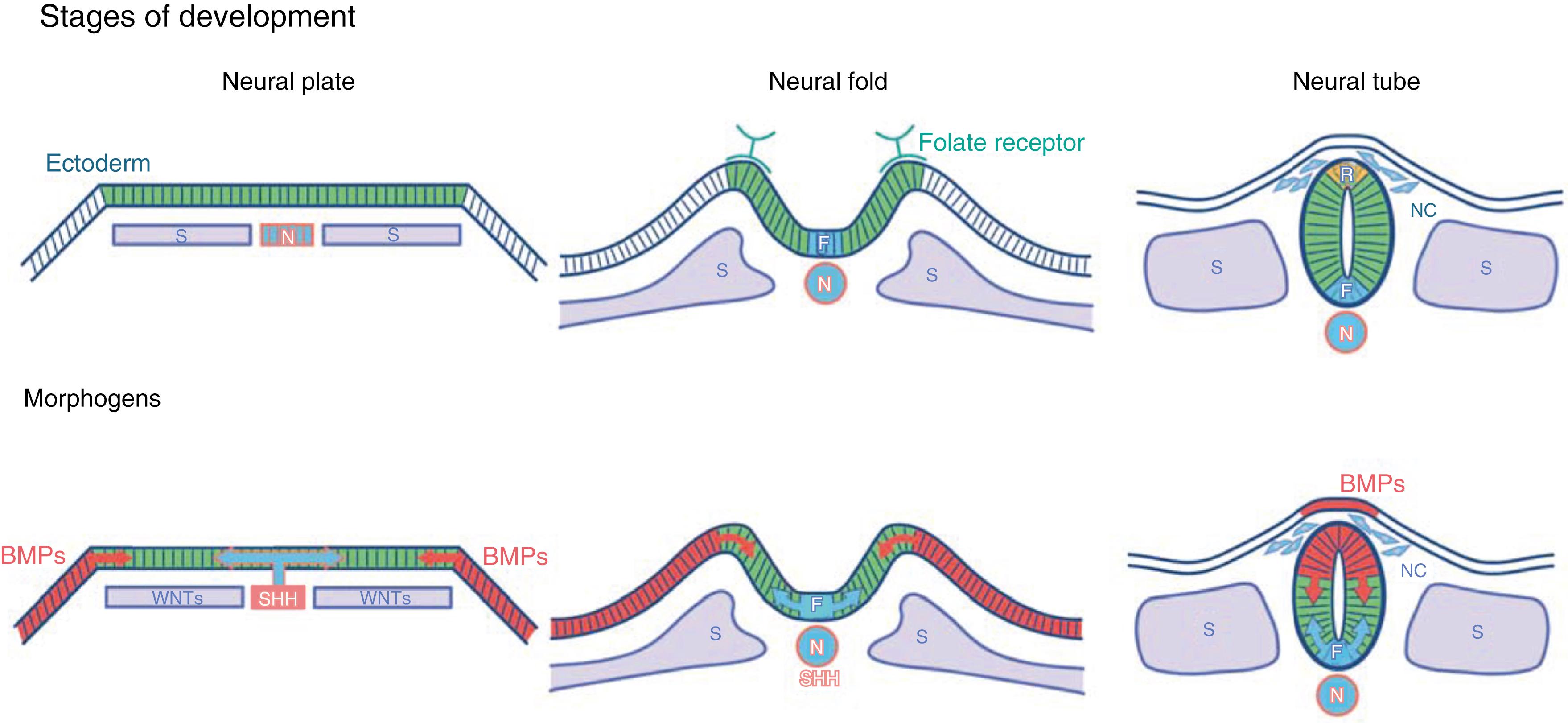 Fig. 127.1, Bone morphogenetic protein (BMP) , sonic hedgehog (SHH) , and Wnt gradients induce neural plate folding and neural tube formation they also specify neural tube and neural crest cells (NC) . Notochord (N) and floorplate (F) are sources for SHH. S, Somite. Folate signals via folate receptor 1 to drive redistribution of neural plate adhesion molecules, neural plate cell elongation, neural plate folding, and neural tube closure. 2