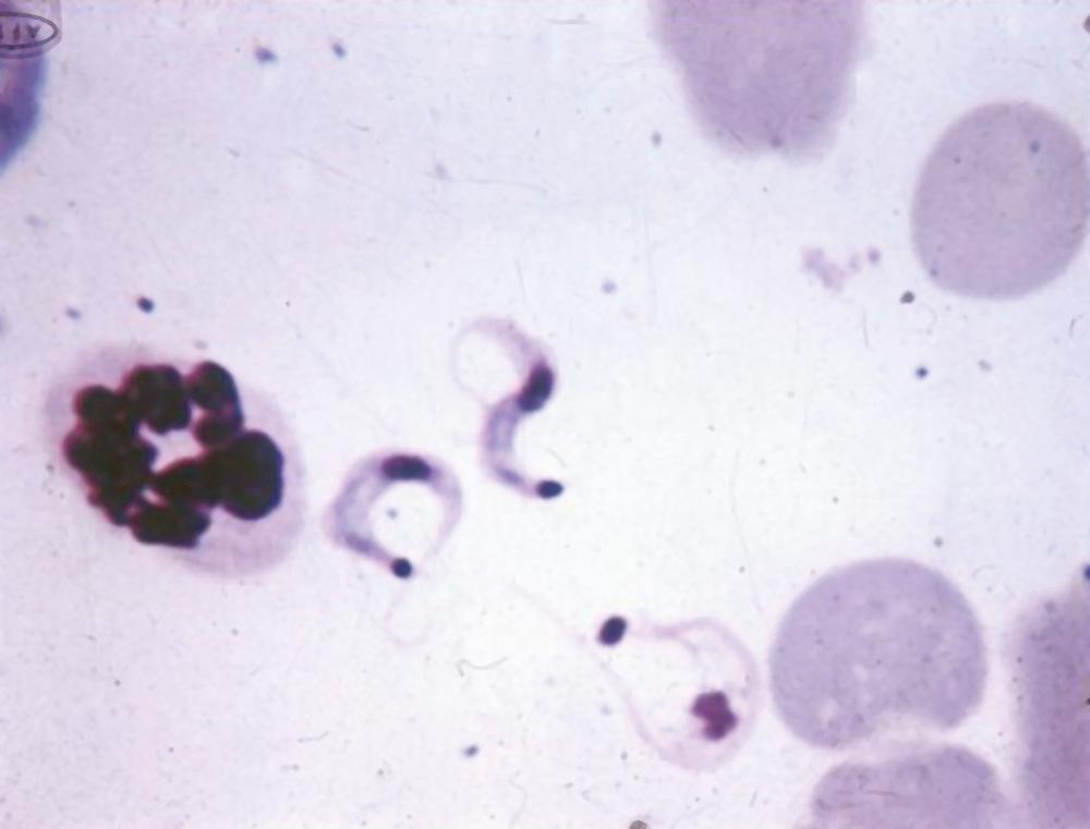 FIG. 276.3, Trypanosoma cruzi trypomastigotes in a smear of mouse blood. (Giemsa stain; magnification ×625).