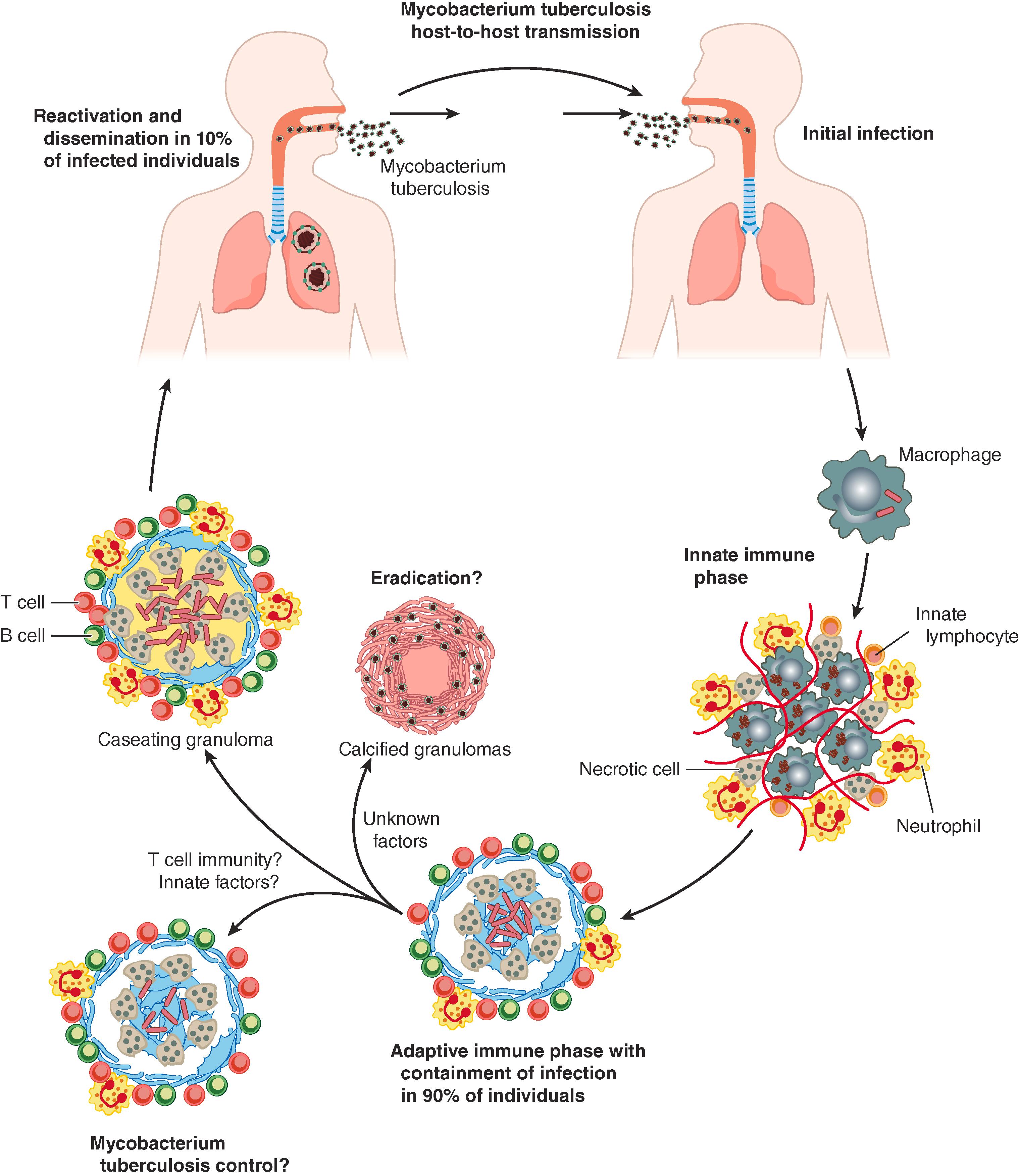 FIGURE 299-2, Pathogenesis of tuberculosis.