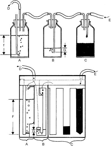 Fig. 31.1, Chest tube apparatus. (A) Suction control chamber; (B) underwater seal; (C) collection chamber; (D) to suction; (E) from patient; (F) height equals amount of suction in units of cm H 2 O; (G) height equals underwater seal in units of cm H 2 O.