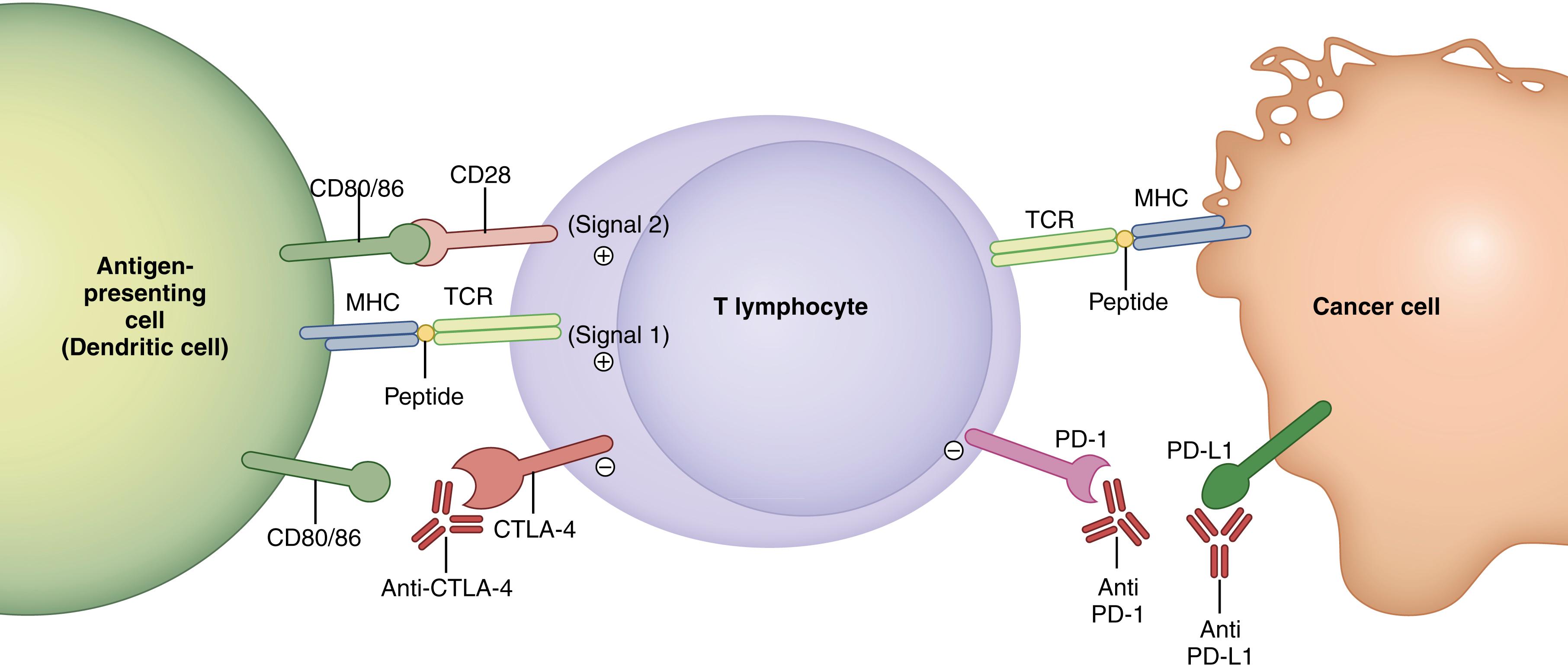 Fig. 30.2, Important activation and inhibitory signaling in T lymphocytes and modern therapeutic interventions. Activation of T cells requires TCR engagement of antigen in the context of MHC and a second costimulatory signal, CD80/86 and CD28. Inhibitory signaling by CTLA-4 or PD-1/PD-L1 can be blocked with monoclonal antibodies . CTLA-4 , Cytotoxic T lymphocyte–associated antigen 4; MHC , major histocompatibility complex; MHLC abbreviation is not in figure. PD-1 , programmed cell death receptor 1; PD-L1 , programmed cell death receptor 1 ligand; TCR , T-cell receptor.