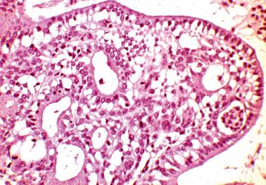 Fig. 4.36, Microglandular hyperplasia, typical appearance. Note subnuclear vacuoles.