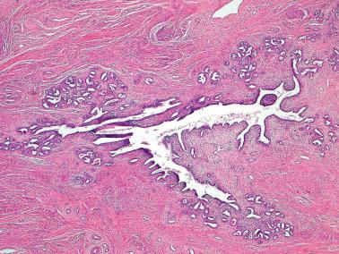 Fig. 4.51, Mesonephric remnant. A mesonephric duct is surrounded by lobular clusters of mesonephric tubules.