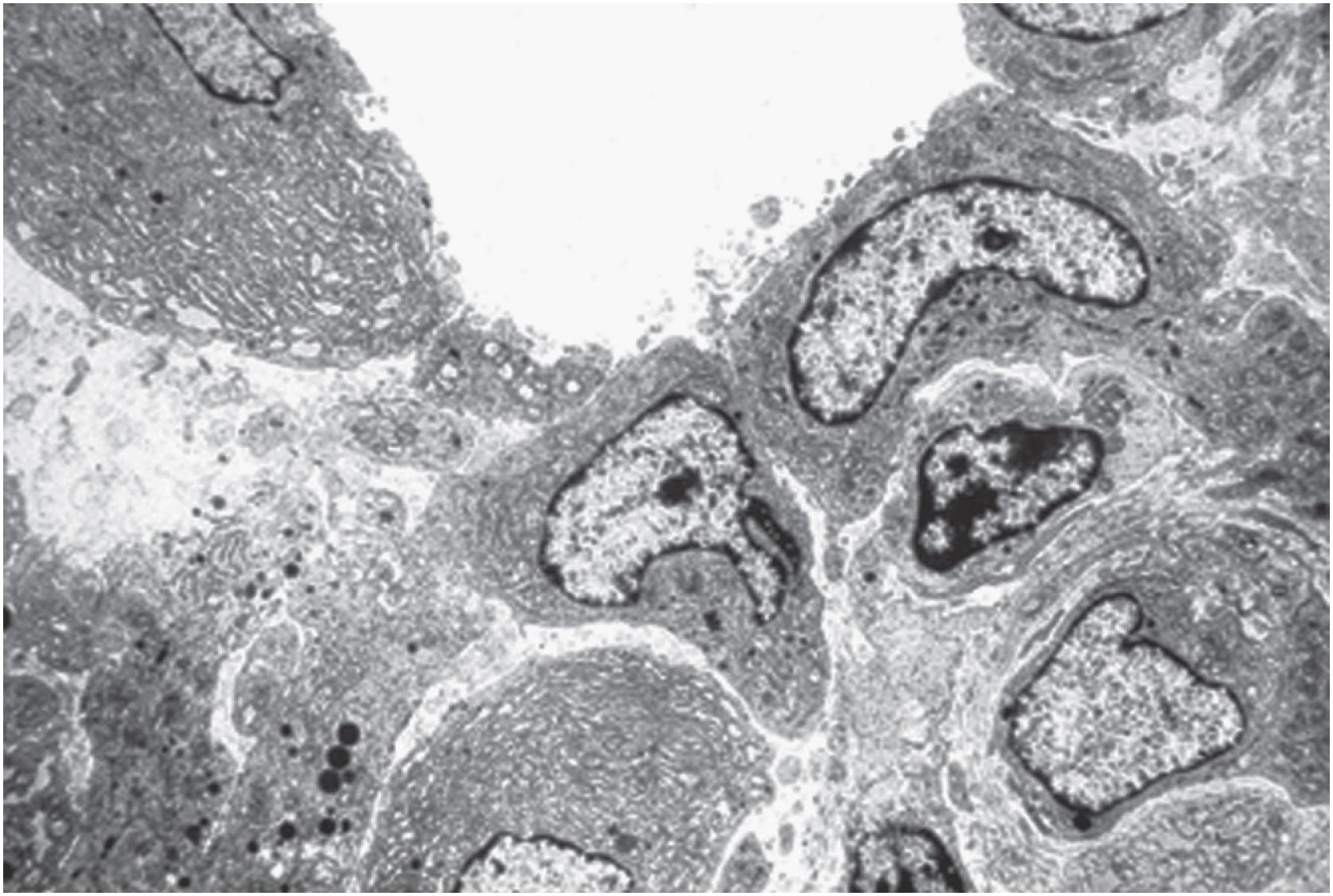 Fig. 13.4, Electron microscopy. Synoviocytes adhere directly to the underlying connective tissue without any basement membrane.