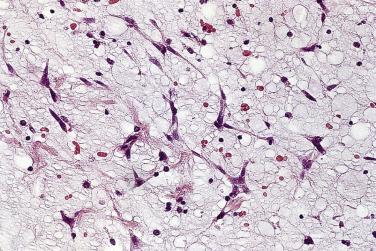 FIG. 2.8, Myxoma cells, some stellate, some elongate, set in myxoid stroma.