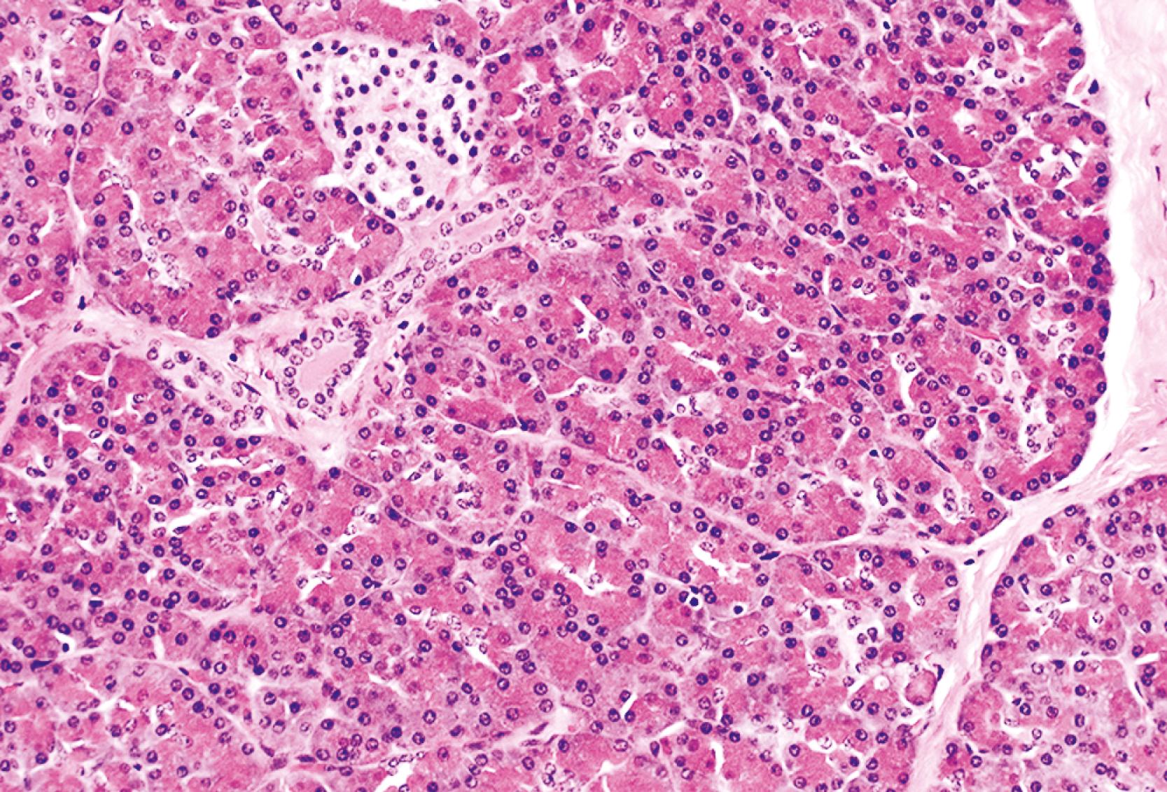 FIGURE 41.1, The normal pancreas. Most of the epithelial elements in the pancreas are acinar cells, which drain their secretions into the terminal portion of the ductal system (lined by centroacinar cells) and then into increasingly larger ducts. In the normal pancreas, the ducts are relatively inconspicuous and are lined by a single layer of cuboidal epithelial cells without obvious mucin. The third epithelial component, (neuroendocrine cells) are largely contained within the islets of Langerhans.