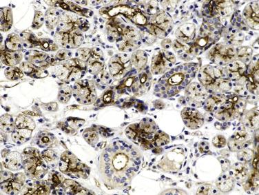 FIG. 7.3, The normal parotid gland. (A) Immunostaining for epithelial membrane antigen (EMA) highlights the luminal borders of the secretory cells and ducts. Note the canalicular pattern observed in the acini. (B) Immunostaining for DOG1 selectively highlights the luminal borders of the acinic cells, in a characteristic canalicular pattern.