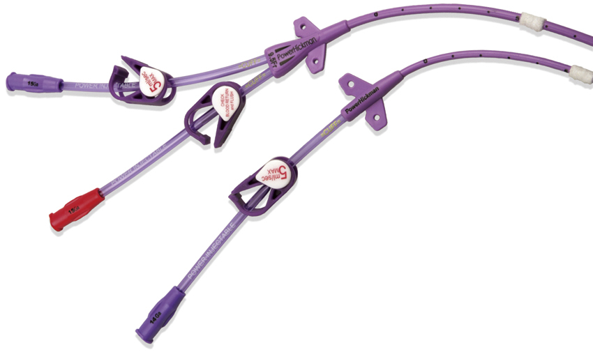 Fig. 84.1, The POWERHICKMAN single (8F) and dual (9.5F) catheter. Note clear markings of power injection limits on catheter clamps. Bard Access Systems also uses the color purple to identify its power injection catheter.