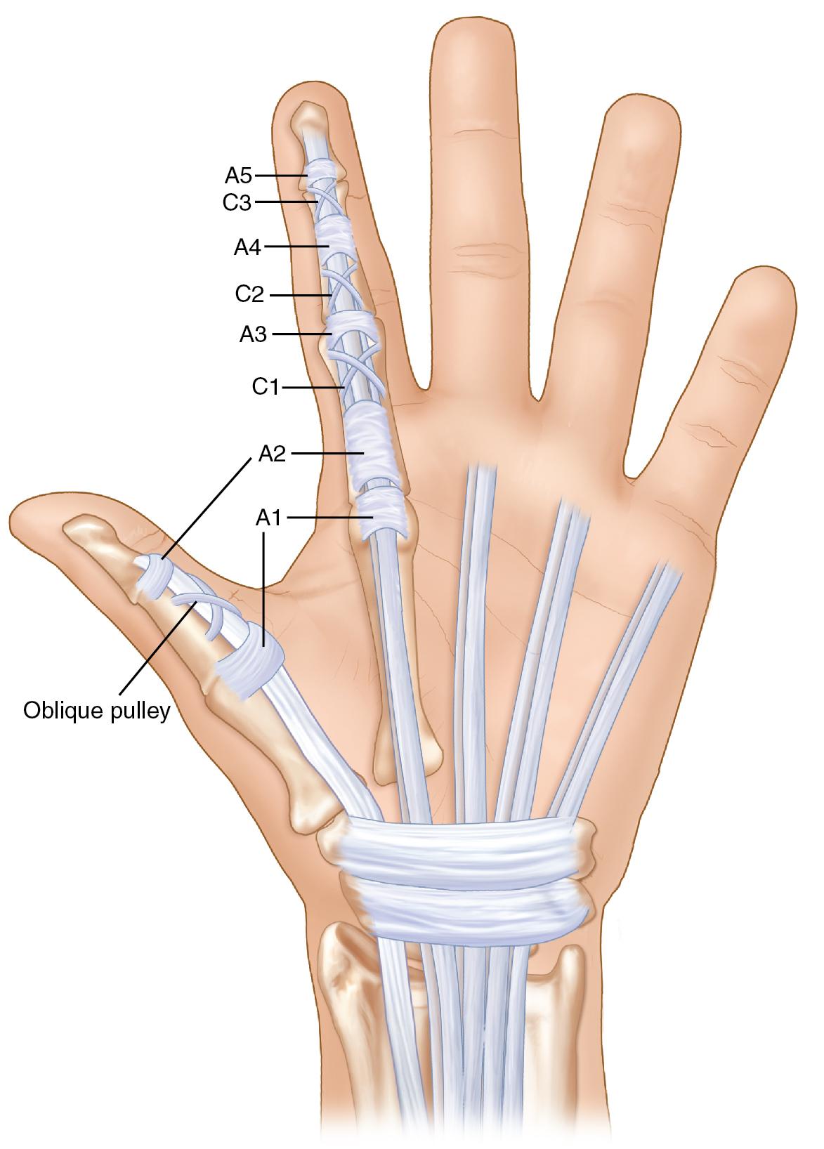 FIGURE 79.2, Key anatomic landmarks for flexor tendons.