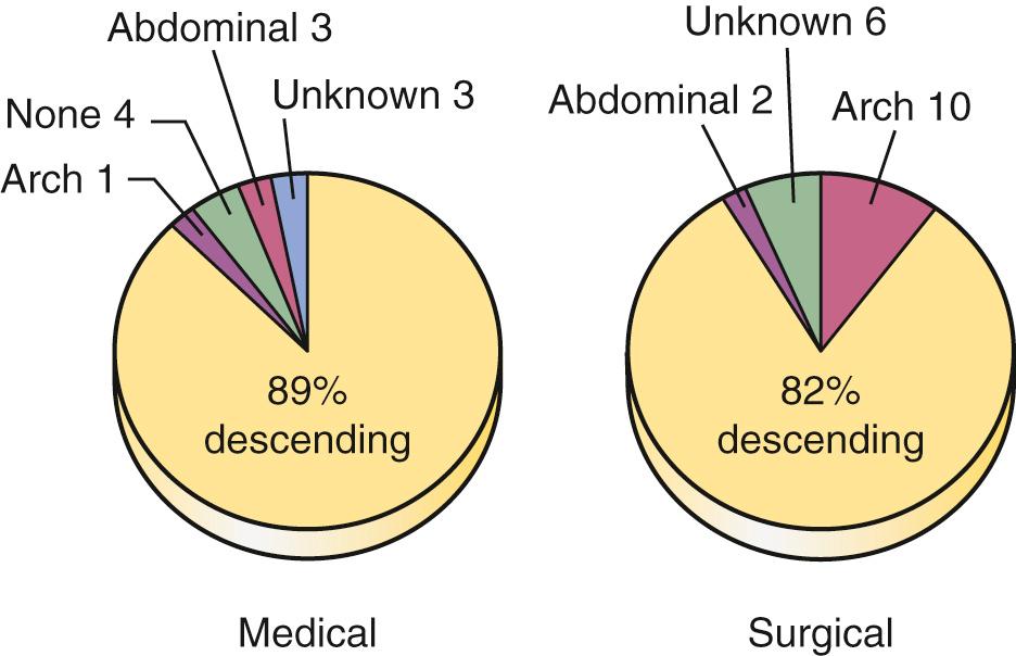 FIGURE 71-1, Site of primary intimal tear in 189 patients with acute type B aortic dissection treated at Stanford between 1963 and 1999, broken down into medical and surgical subgroups.