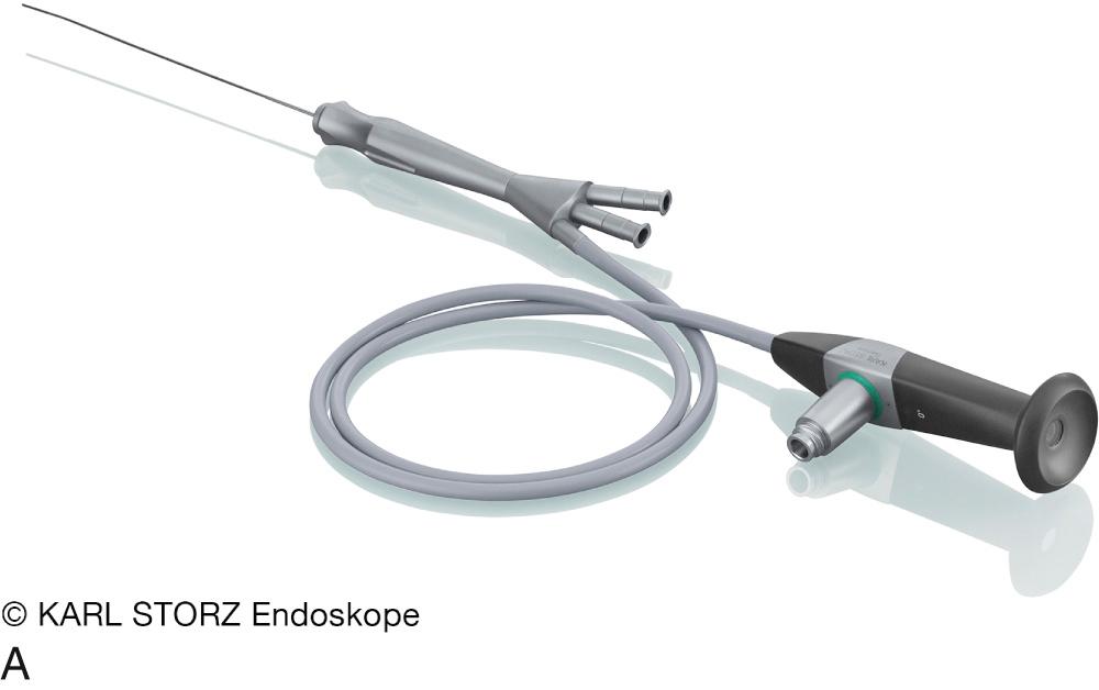 Fig. 14.1.4, Marchal “all-in-one” sialendoscopes of 0.89 mm, 1.1 mm, 1.3 mm, 1.6 mm, having all working channels (WC) and/or rinsing channels (RC). (A) Larger sialendoscopes of similar appearance: 1.1 mm (WC 0.45, RC 0.25); 1.3 mm (WC 0.65, RC 0.25); 1.6 mm (WC 0.8, RC 0.25). (B) Small sialendoscope of 0.89 mm (WC or RC 0.25).