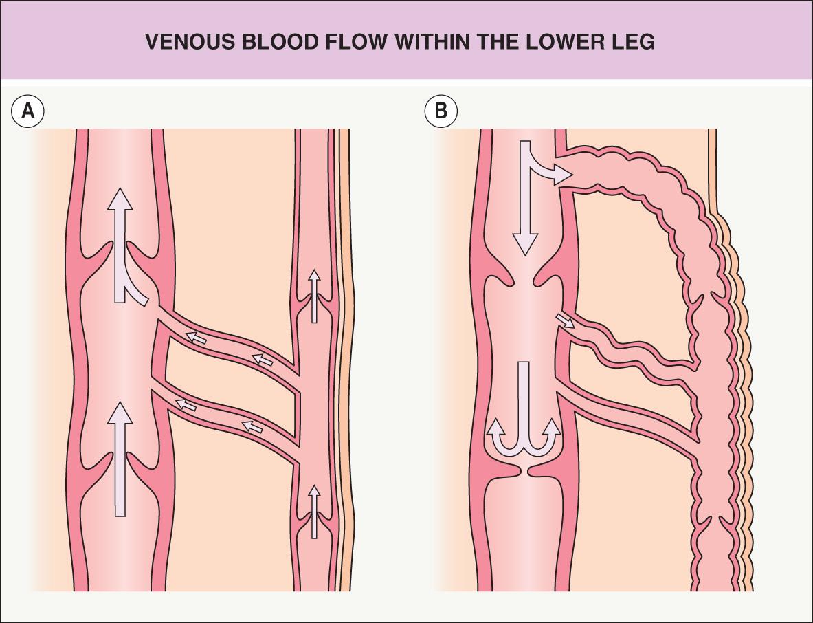 Fig. 105.2, Venous blood flow within the lower leg.