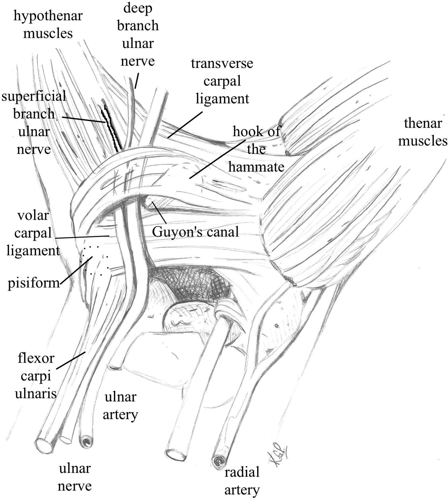 Ulnar Nerve Clinical Tree