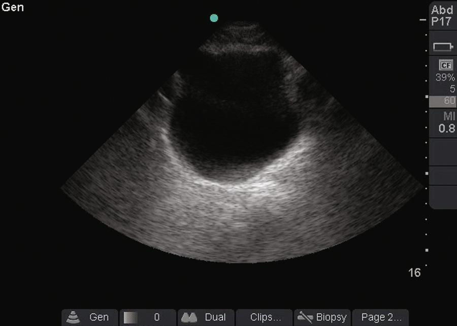 Figure 66.1, This image demonstrates a fluid-filled bladder, which appears black, or anechoic, when viewed with ultrasound.