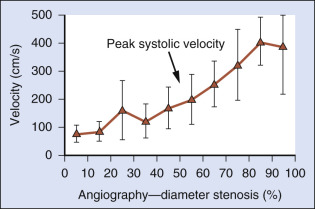 FIG. 7.4, Graph demonstrating the relationship between average peak systolic velocity (PSV) (y-axis) and percentage luminal narrowing as determined by contrast angiography using, North American Symptomatic Carotid Endarterectomy Trial (NASCET) method of measurement (x-axis). Average PSV clearly increases with increasing severity of angiographically determined stenosis. Error bars show one standard deviation about mean. Each bin represents an average of PSV values over a 10% stenosis range (i.e., the 45% point represents the average between 40% and 50% stenosis).