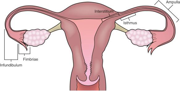 FIG 31-1, Schematic diagram demonstrating the anatomy of the normal fallopian tube.