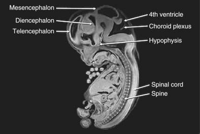 FIG 9-4, Sectional magnetic resonance image of Carnegie stage 23 (10 weeks’ gestational age) human embryo.