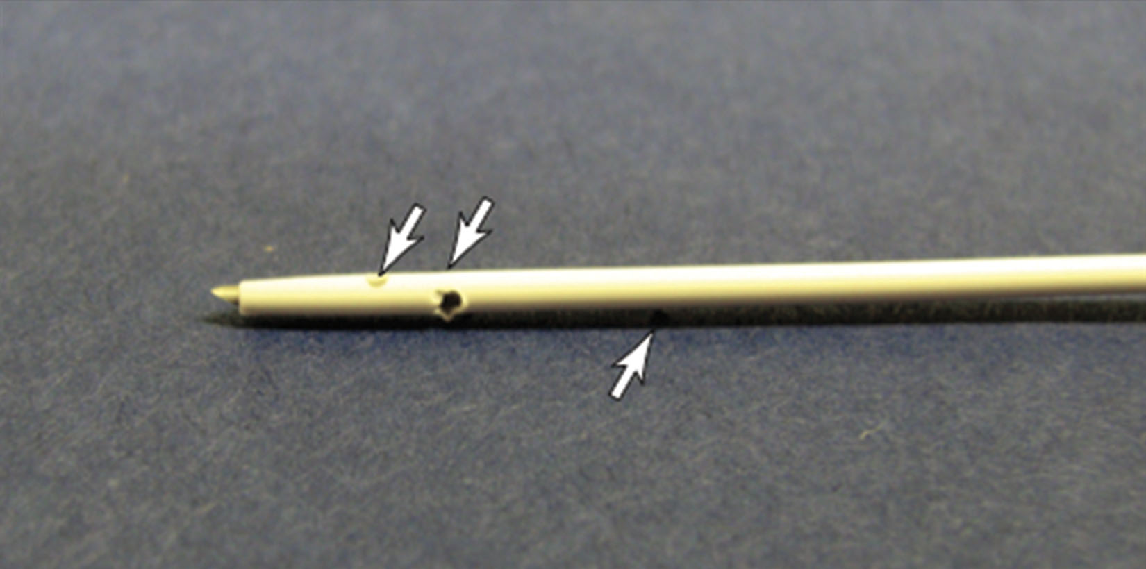 Fig. 18.13, A centesis catheter. The arrows point to the side holes.