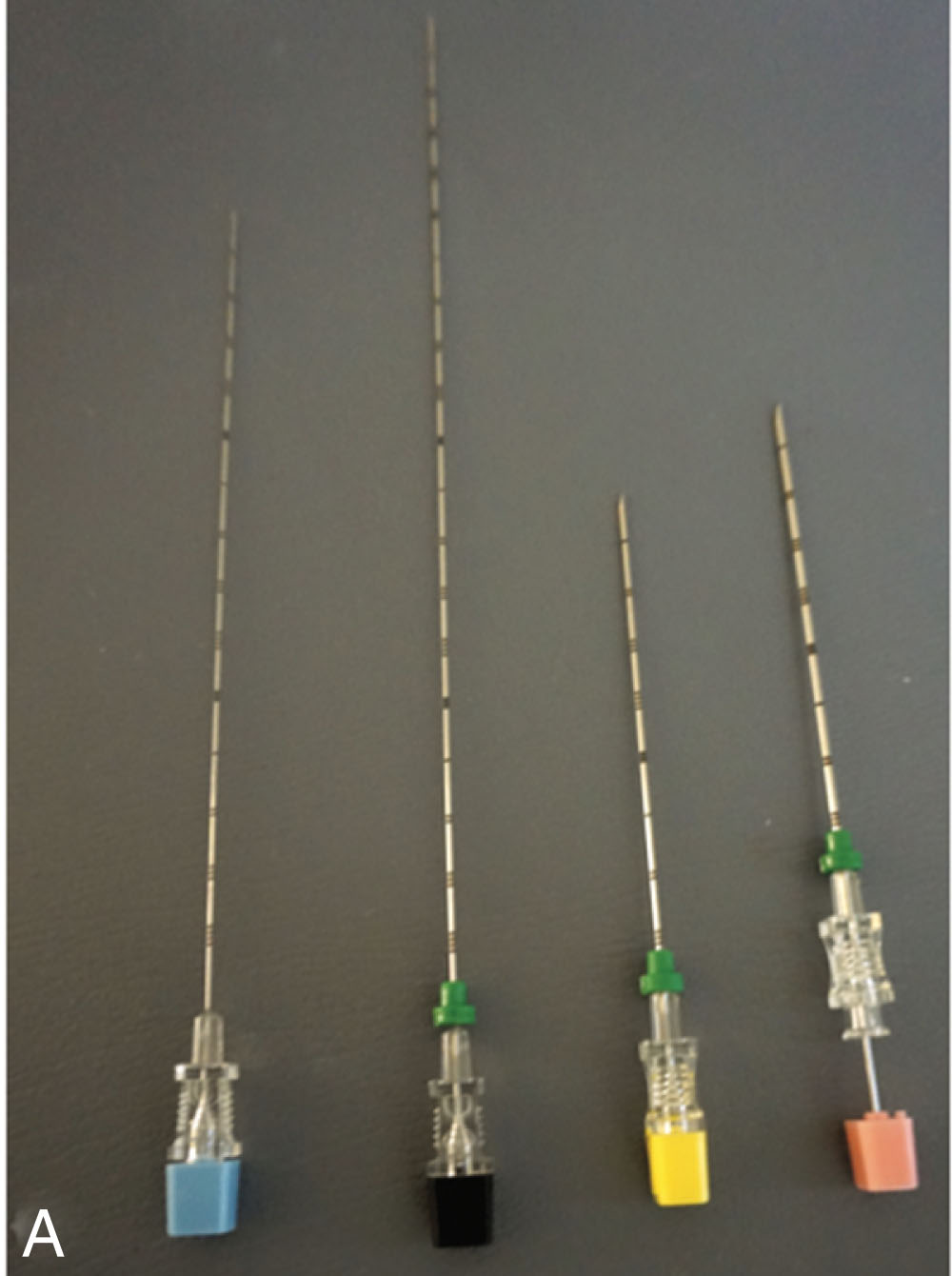 Fig. 18.8, (A) Different types of needles and gauges used for fine-needle aspiration biopsies. Blue: 25 gauge × 15 cm; black: 22 gauge × 20 cm; yellow: 20 gauge × 9 cm; pink: 18 gauge × 9 cm. (B) Different types of needle tips. From top: Chiba, Franseen, Spinal.