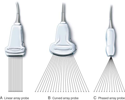 FIGURE 43.4, Schematic diagram illustrating the different types of ultrasound transducers. Note how the ultrasound beam is emitted from each of these transducers.