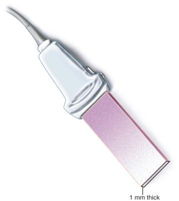 FIGURE 43.7, The plane of ultrasound imaging. Note that the ultrasound beam is only 1 mm thick and for a needle to be visible during an ultrasound-guided intervention it must lie within this plane of imaging.