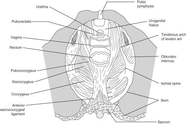 FIG 35-1, Pelvic floor muscle anatomy. Pelvic floor muscles fill up the “bowl” of the pelvis. The levator ani muscles are composed of the puborectalis, pubococcygeus, and iliococcygeus portions.