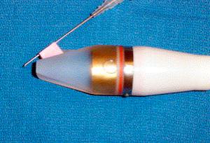 F igure 69-2-7, Ultrasound transducer with needle inserted through a mechanical guide.