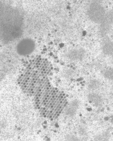 Figure 5.6, Adenovirus (original magnification, ×34,000). Numerous packets of virions in a regular latticelike arrangement are seen.