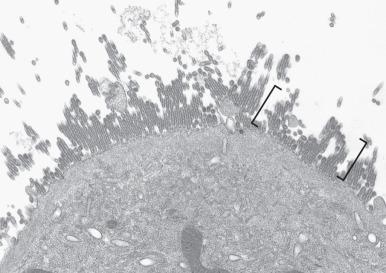 Figure 5.7, Influenza A (original magnification, ×15,000). Round and elongate virions at the cell surface are seen in cell culture (brackets) .