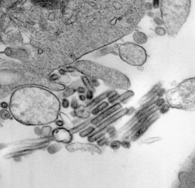 Figure 5.8, Influenza A (original magnification, ×45,000). Round and elongated virions are seen.