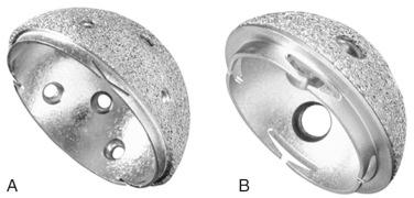 Fig. 64.1, Harris-Galante (HG)-1 (A) and HG-2 (B) cups.