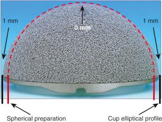 Fig. 64.3, Hemi-ellipsoid shape of a trabecular metal acetabular monoblock shell.