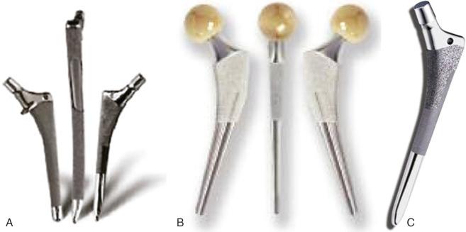 Fig. 69.1, The section of the femoral component that engages the diaphysis contributes to the initial stability of the device. This portion of the component may be cylindrical or tapered and may be porous coated, hydroxyapatite coated, grit-blasted, smooth, or a combination thereof. (A) Cylindrical with various coating lengths. (B) Narrow tapered stem. (C) Anatomic tapered stem.