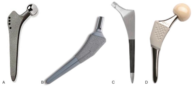 Fig. 69.4, Tapered stem designs may achieve proximal stability with (A) rectangular shapes (Zweymüller), (B) antirotation lateral wedges (Taperloc, Zimmer Biomet), (C) wedge-shaped proximal geometries (Synergy, Smith & Nephew), and (D) anatomic-fit/fill-metaphyseal designs (ABG, Stryker).