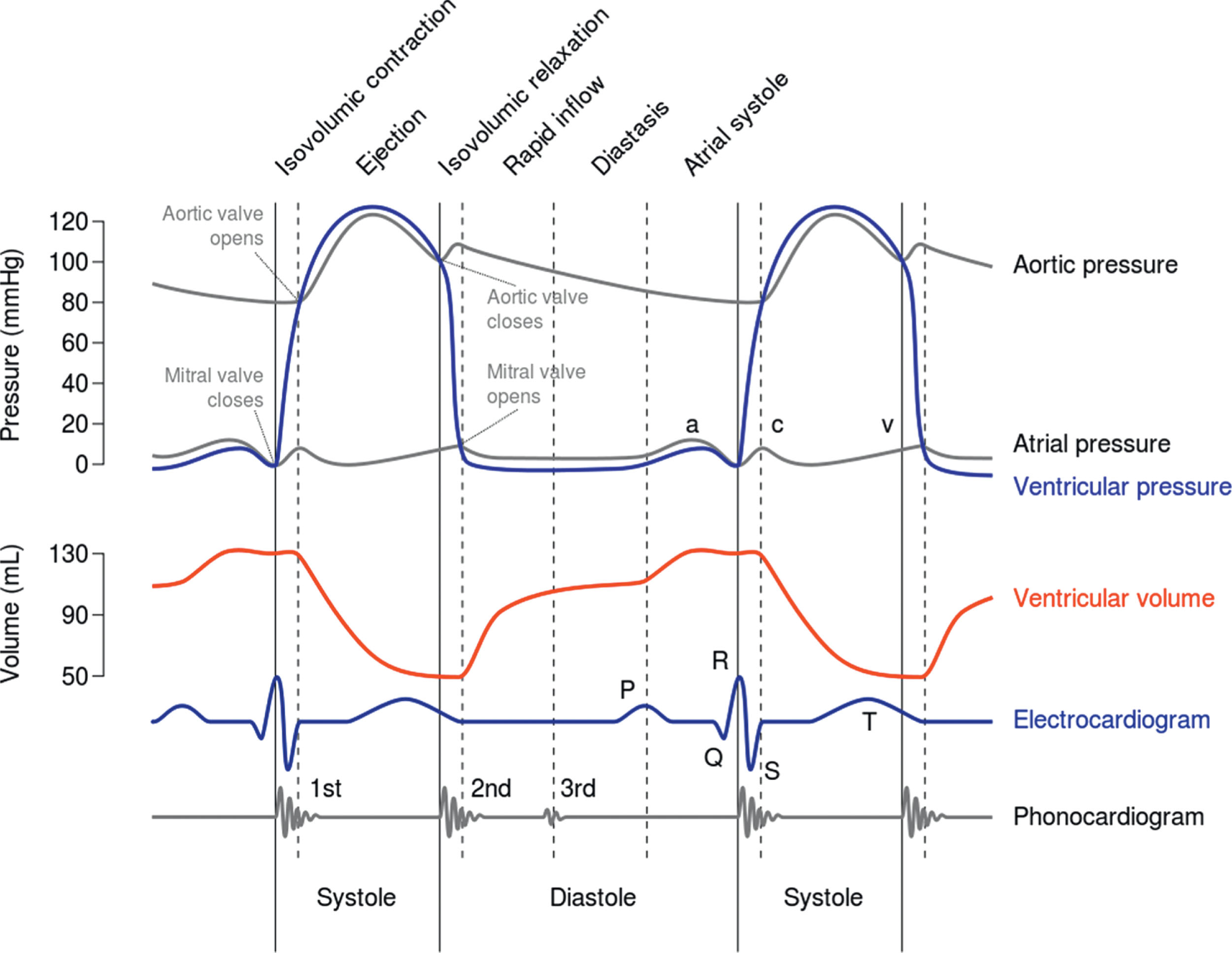 Fig. 31.1, The Wiggers diagram shows the normal relationships between the chamber pressures, volumes, and heart sounds timed with the electrocardiogram for the left side of the heart.