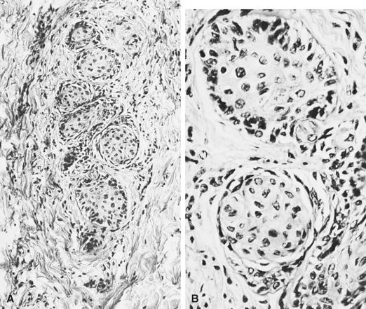 Figure 4.3, Low-power (A) and high-power (B) views of juxtaoral organ of Chievitz.