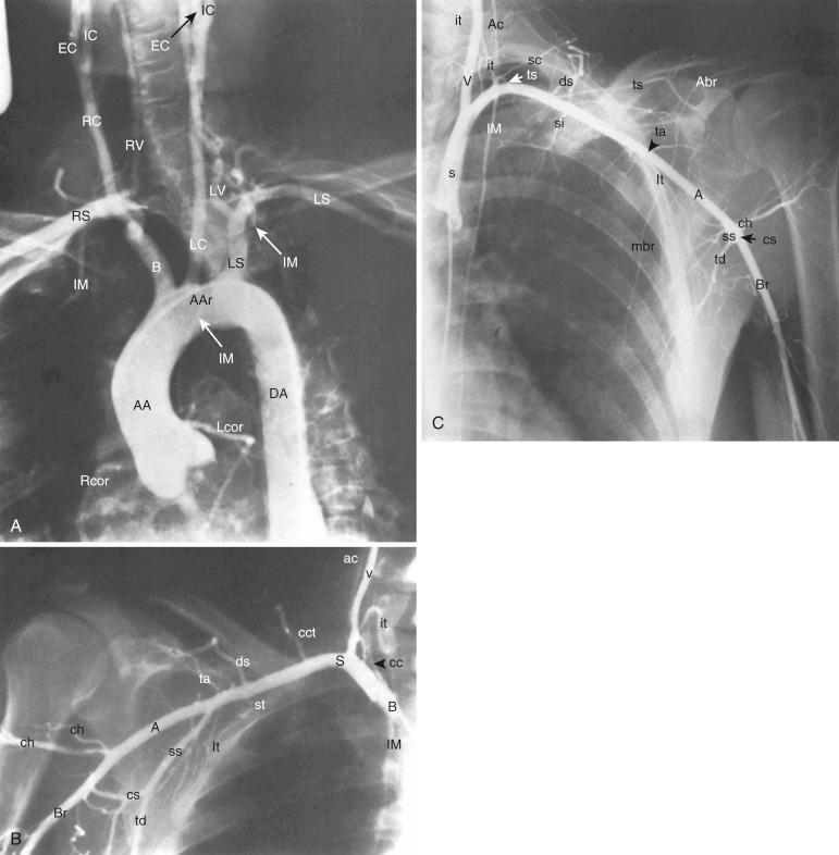 Fig. 40.1, Normal anatomy.