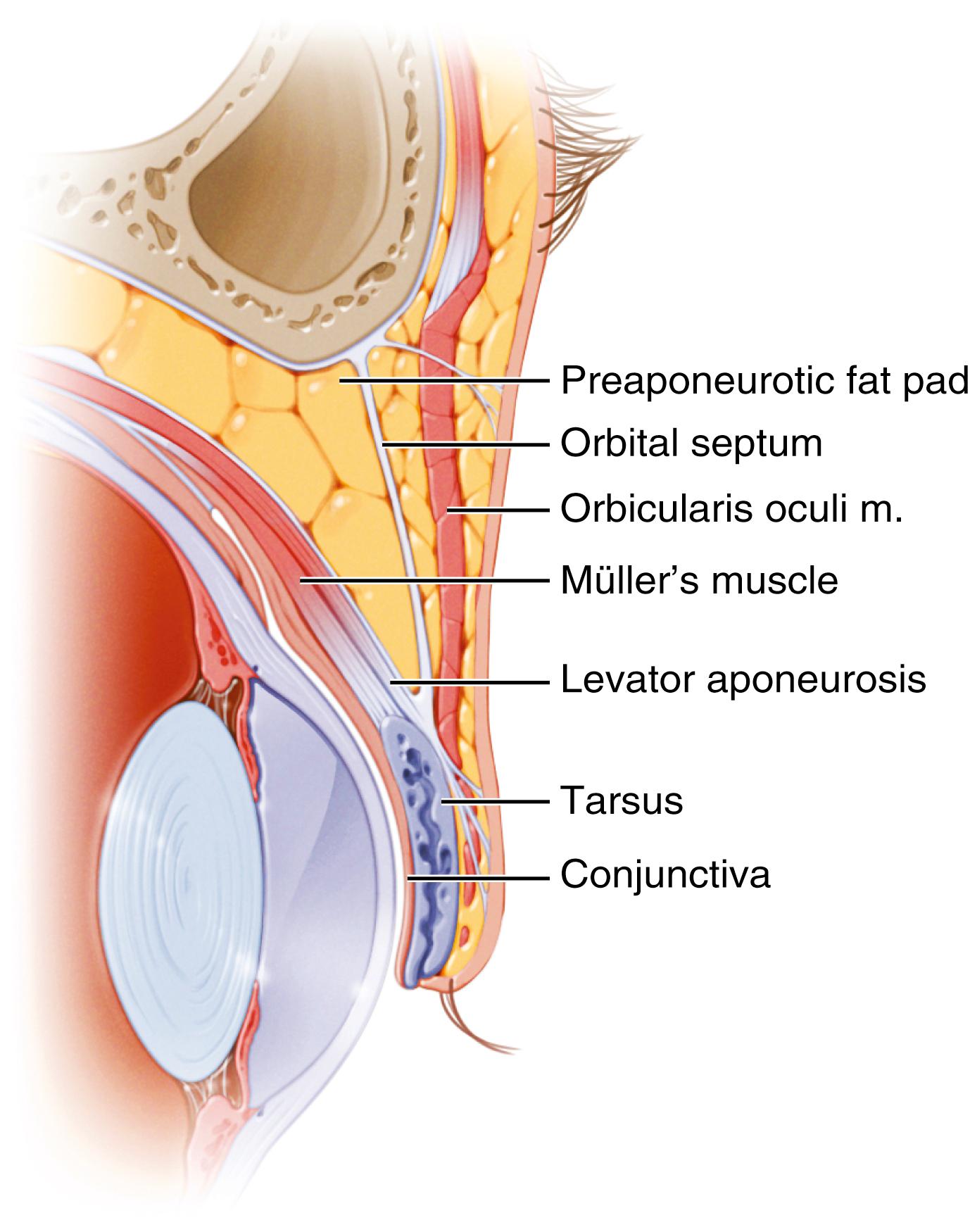 Fig. 64.2, Sagittal view of the upper eyelid demonstrating important anatomic layers. m., muscle.